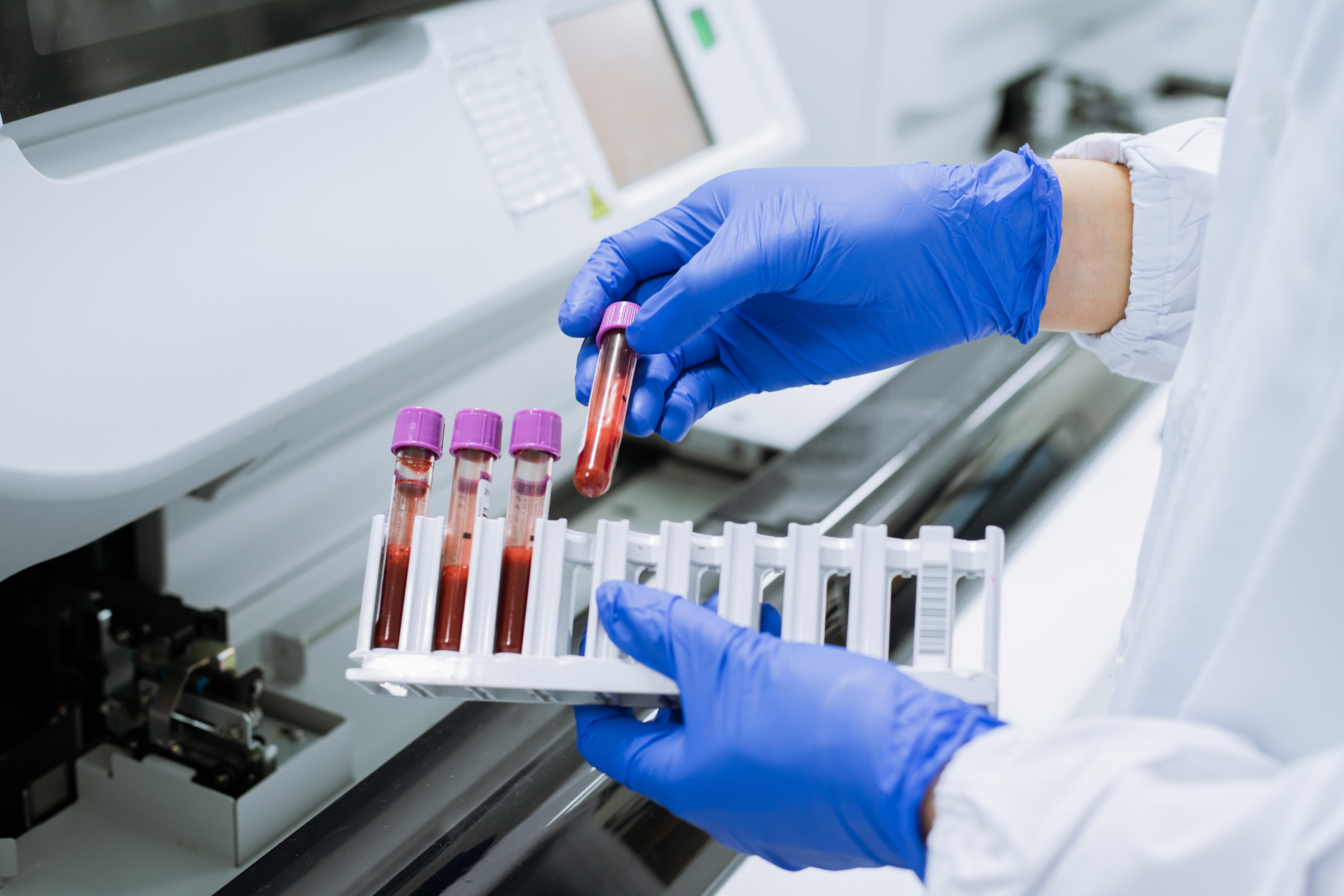 臨床検査技師の転職面接では何が聞かれるの？よくある質問と回答を紹介