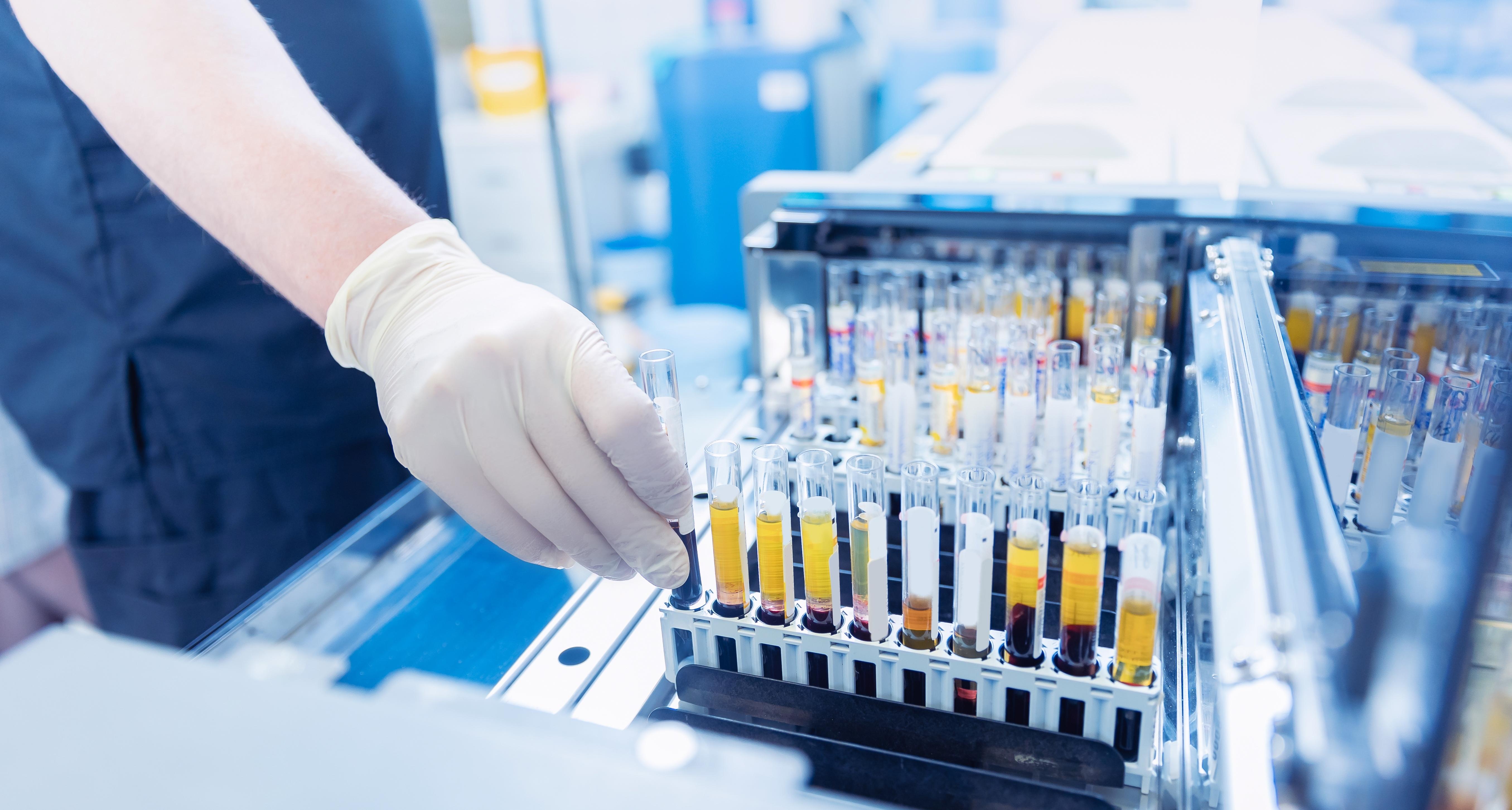 臨床検査技師の多くは病院に勤務！人気の理由を紹介