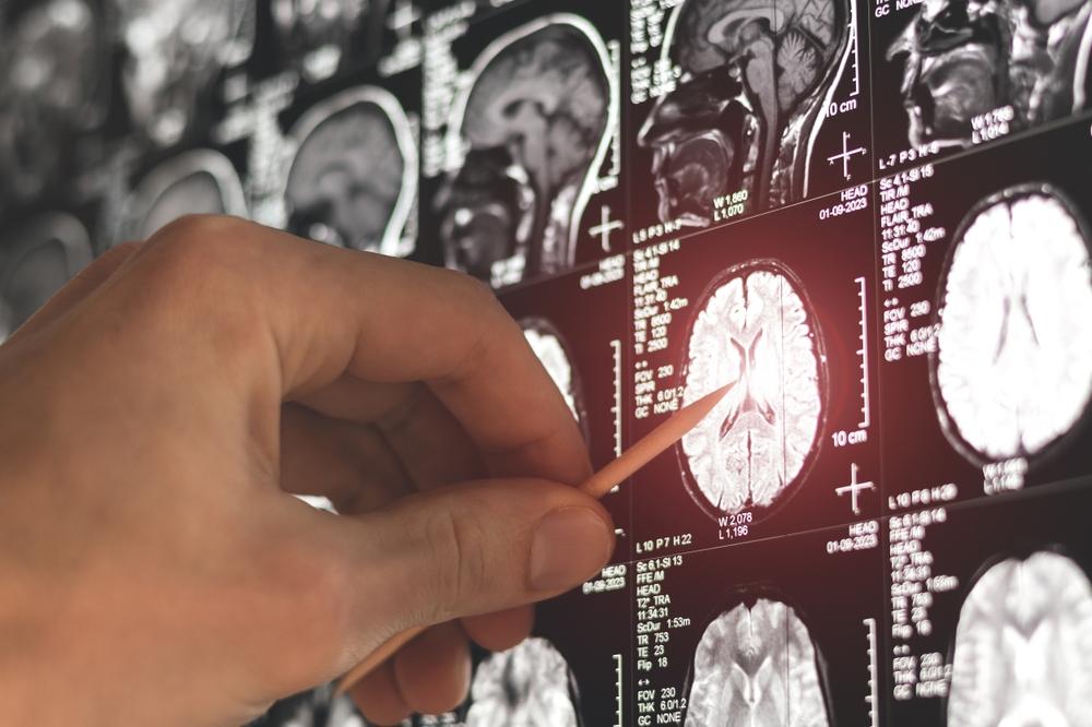 放射線科は危険？よくある疑問