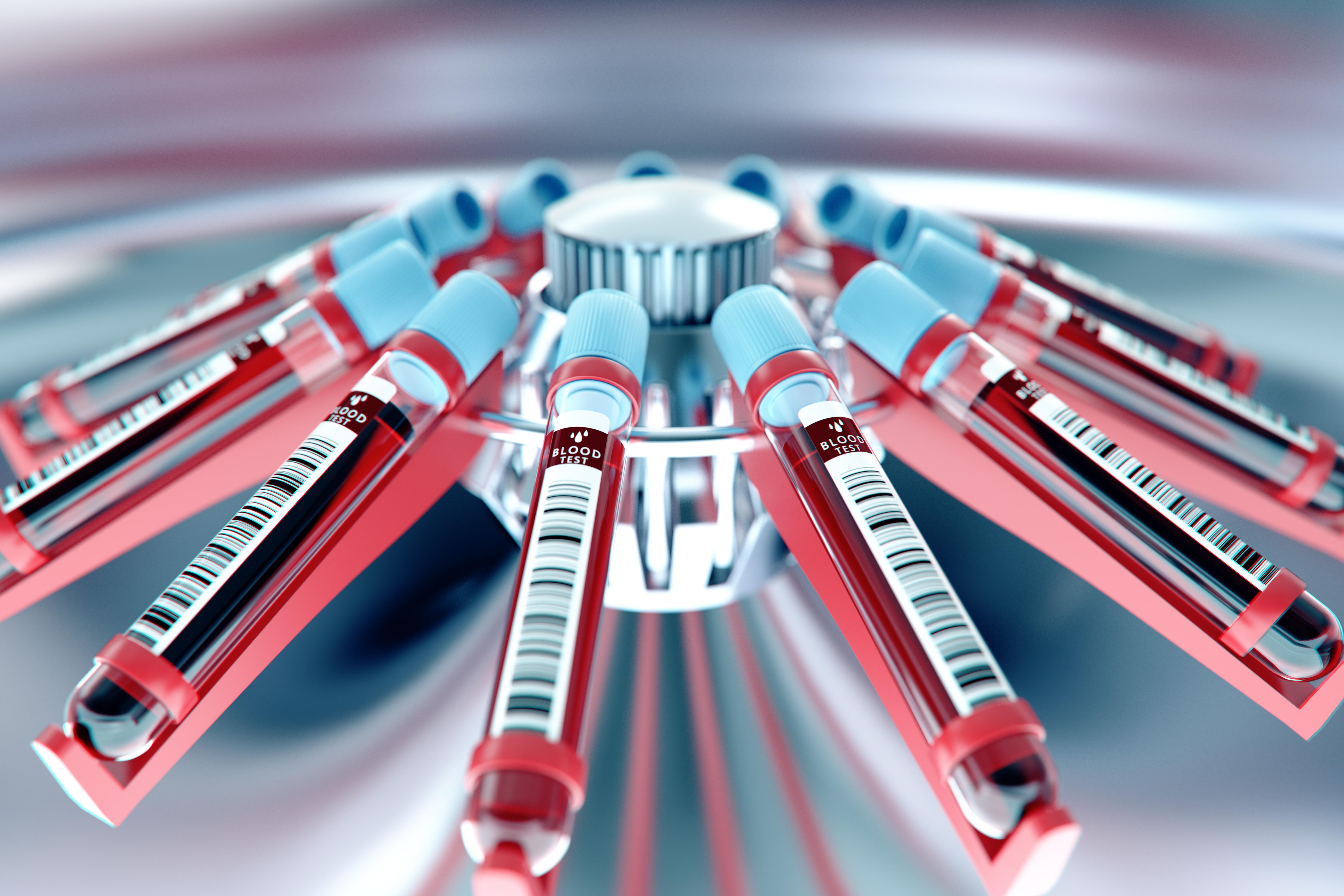 臨床検査技師を辞めたくなる理由とは？代表的な例を紹介